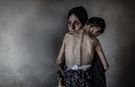 Gazze’de Açlık Can Almaya Devam Ediyor: 1’i Çocuk 5 Kişi Daha Hayatını Kaybetti