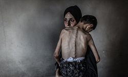 Gazze’de Açlık Can Almaya Devam Ediyor: 1’i Çocuk 5 Kişi Daha Hayatını Kaybetti