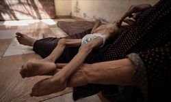 Gazze’de açlık can almaya devam ediyor: 2’si çocuk 5 ölü
