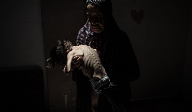 Gazze’de açlıktan ölenlerin sayısı 239’a yükseldi