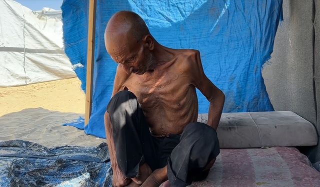 Gazze’de 75 yaşındaki adam açlık nedeniyle 40 kiloya düştü