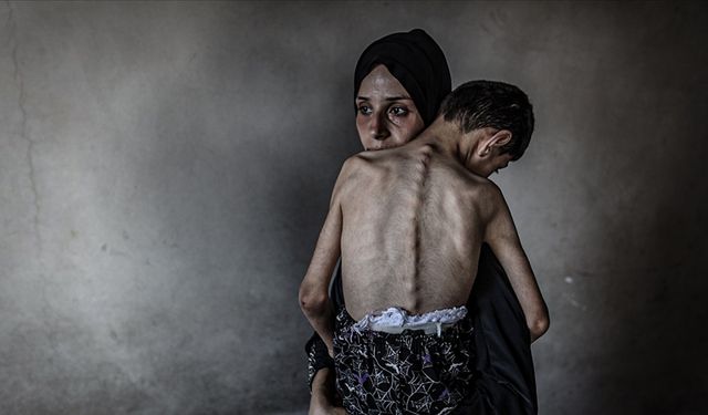 Gazze’de Açlık Can Almaya Devam Ediyor: 1’i Çocuk 5 Kişi Daha Hayatını Kaybetti