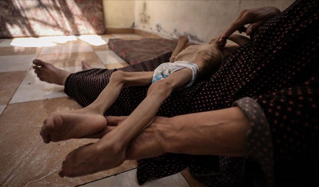 Gazze’de açlık can almaya devam ediyor: 2’si çocuk 5 ölü